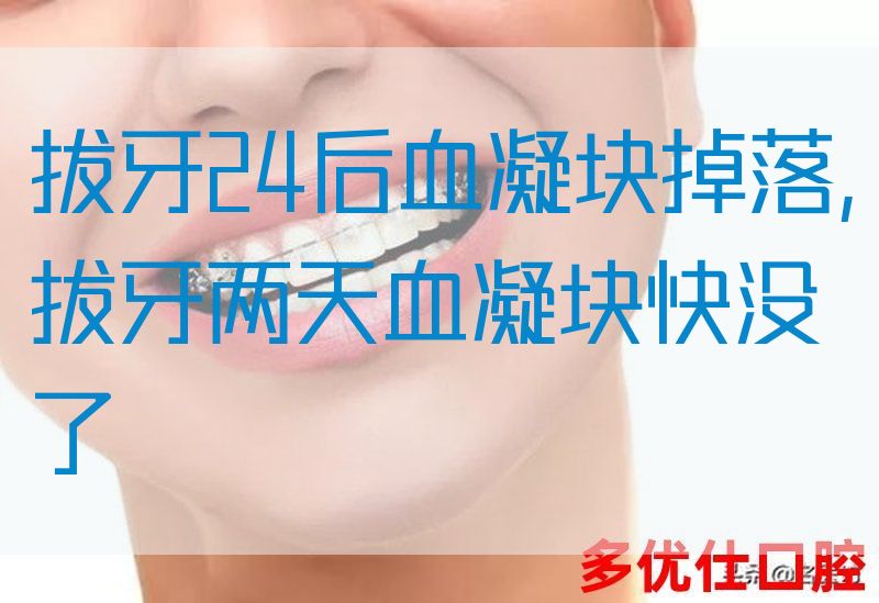 拔牙24后血凝块掉落,拔牙两天血凝块快没了(图1)