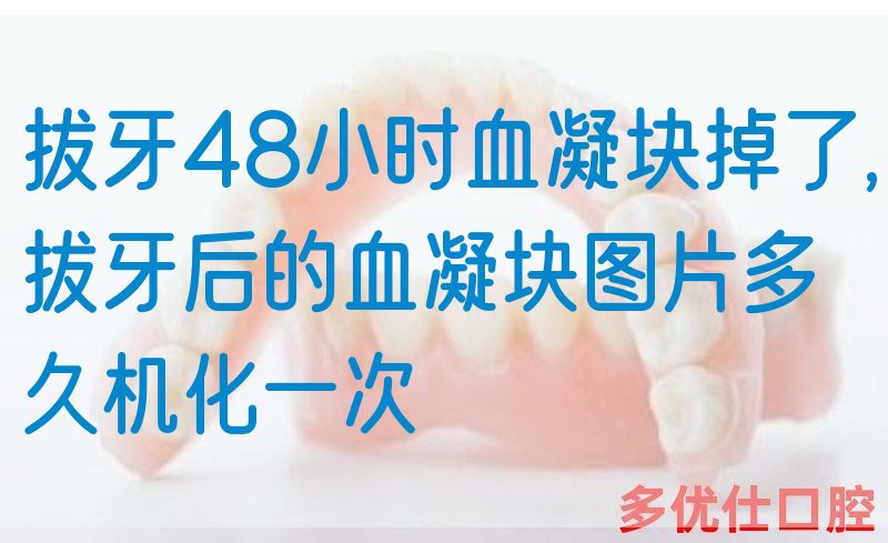 拔牙48小时血凝块掉了,拔牙后的血凝块图片多久机化一次(图1)
