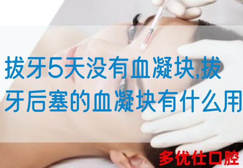 拔牙5天没有血凝块,拔牙后塞的血凝块有什么用(图1)