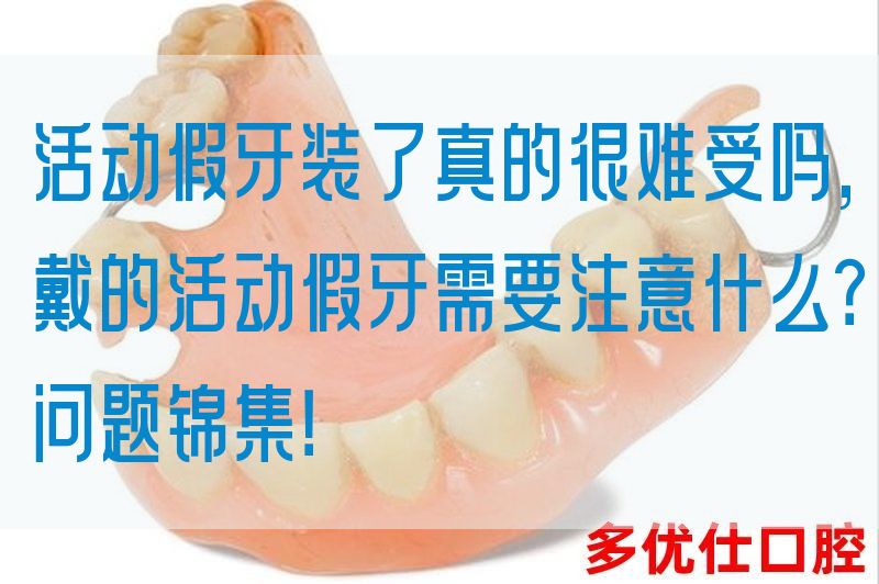 活动假牙装了真的很难受吗,戴的活动假牙需要注意什么？问题锦集！