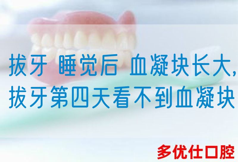 拔牙 *觉后 血凝块长大,拔牙第四天看不到血凝块(图1)
