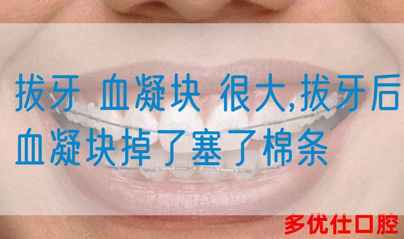 拔牙 血凝块 很大,拔牙后血凝块掉了塞了棉条(图1)