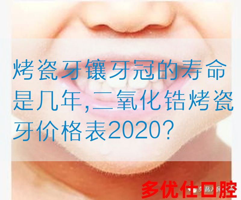 烤瓷牙镶牙冠的寿命是几年,二氧化锆烤瓷牙价格表2020？