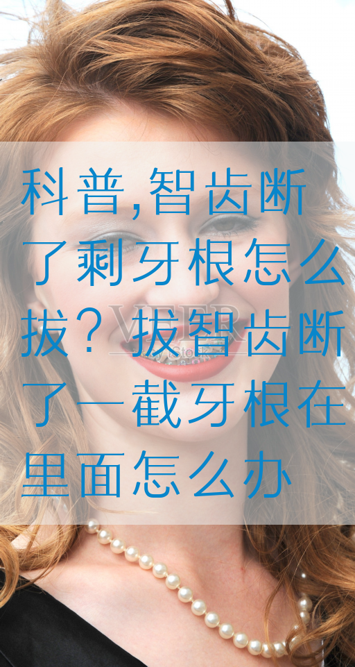 科普,智齿断了剩牙根怎么拔？拔智齿断了一截牙根在里面怎么办(图1)