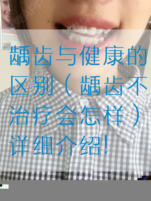 龋齿与健康的区别（龋齿不治疗会怎样）详细介绍!(图1)