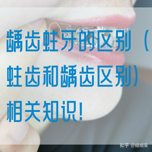 龋齿蛀牙的区别（蛀齿和龋齿区别）相关知识！(图1)