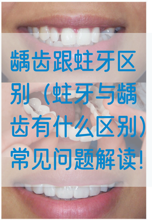 龋齿跟蛀牙区别（蛀牙与龋齿有什么区别）常见问题解读！(图1)