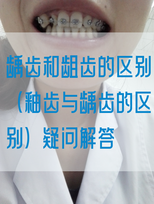 龋齿和龃齿的区别（釉齿与龋齿的区别）疑问解答(图1)