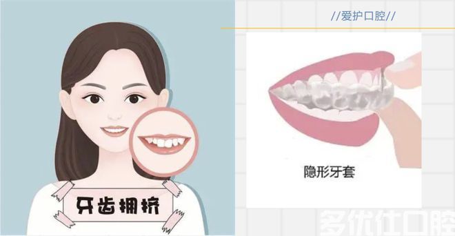 「口腔科普」实用的八个口腔常识！(图7)