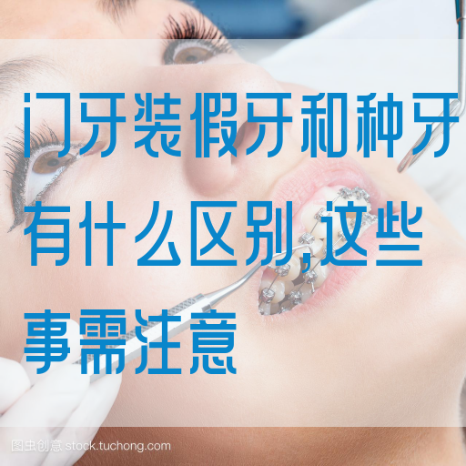 门牙装假牙和种牙有什么区别,这些事需注意(图1)