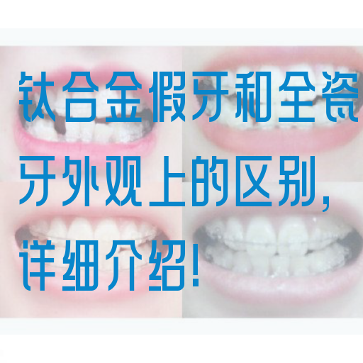 钛合金假牙和全瓷牙外观上的区别,详细介绍!(图1)