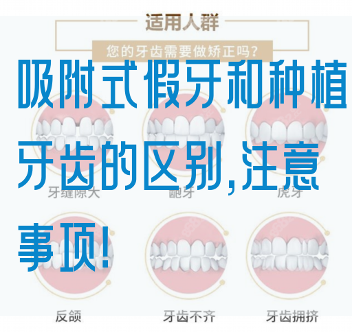 吸附式假牙和种植牙齿的区别,注意事项！(图1)