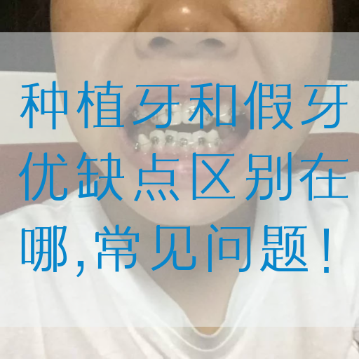 种植牙和假牙优缺点区别在哪,常见问题！(图1)