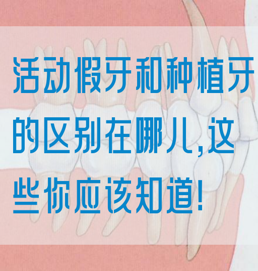 活动假牙和种植牙的区别在哪儿,这些你应该知道！(图1)