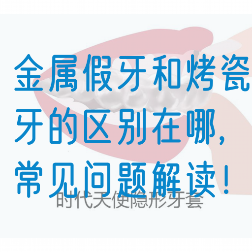 金属假牙和烤瓷牙的区别在哪,常见问题解读！(图1)