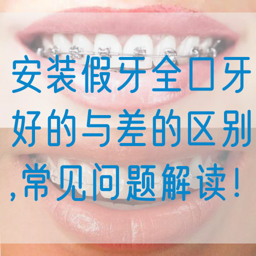 安装假牙全口牙好的与差的区别,常见问题解读！(图1)