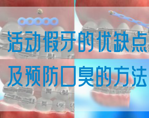 活动假牙的优缺点及预防口臭的方法