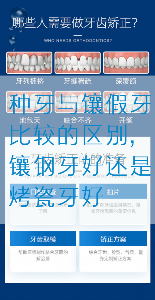 种牙与镶假牙比较的区别,镶钢牙好还是烤瓷牙好(图1)