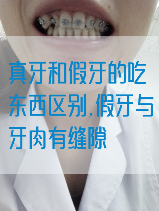 真牙和假牙的吃东西区别,假牙与牙肉有缝隙(图1)