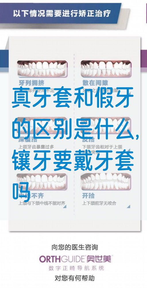 真牙套和假牙的区别是什么,镶牙要戴牙套吗(图1)