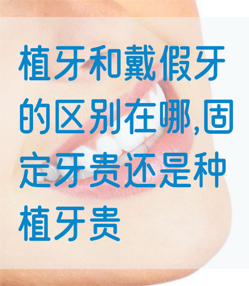 植牙和戴假牙的区别在哪,固定牙贵还是种植牙贵(图1)