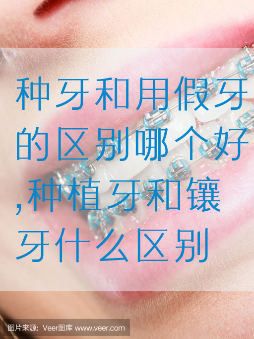 种牙和用假牙的区别哪个好,种植牙和镶牙什么区别(图1)
