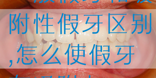 一般假牙和吸附性假牙区别,怎么使假牙有吸附力(图1)