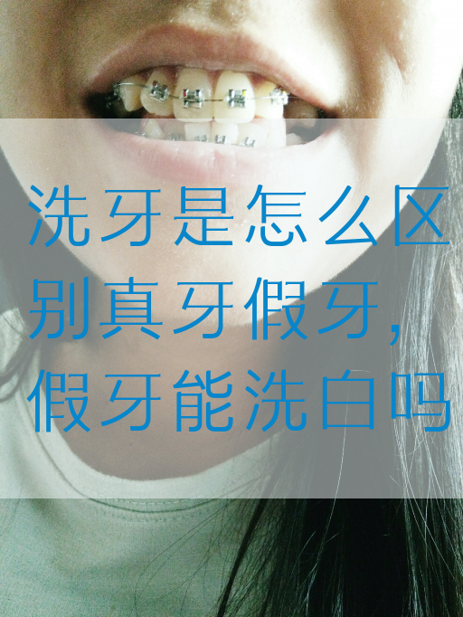 洗牙是怎么区别真牙假牙,假牙能洗白吗(图1)