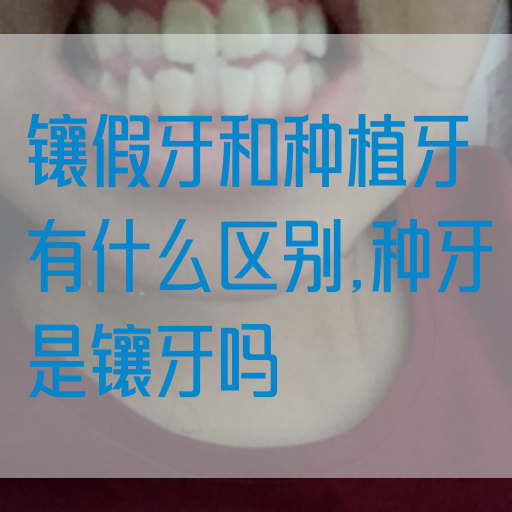 镶假牙和种植牙有什么区别,种牙是镶牙吗(图1)