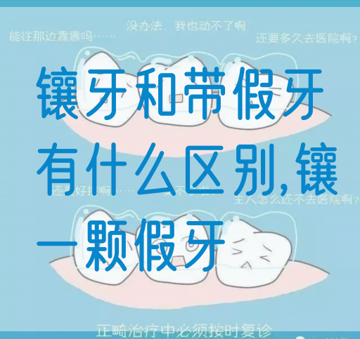 镶牙和带假牙有什么区别,镶一颗假牙(图1)