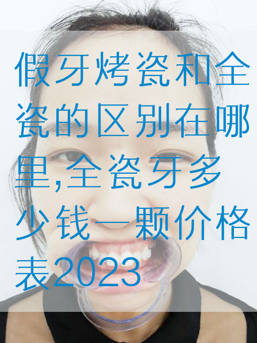 假牙烤瓷和全瓷的区别在哪里,全瓷牙多少钱一颗价格表2023(图1)