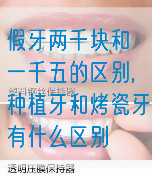 假牙两千块和一千五的区别,种植牙和烤瓷牙有什么区别(图1)