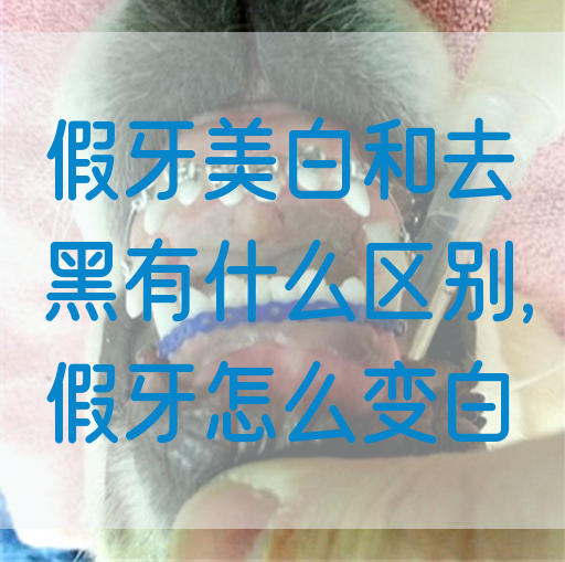 假牙美白和去黑有什么区别,假牙怎么变白(图1)