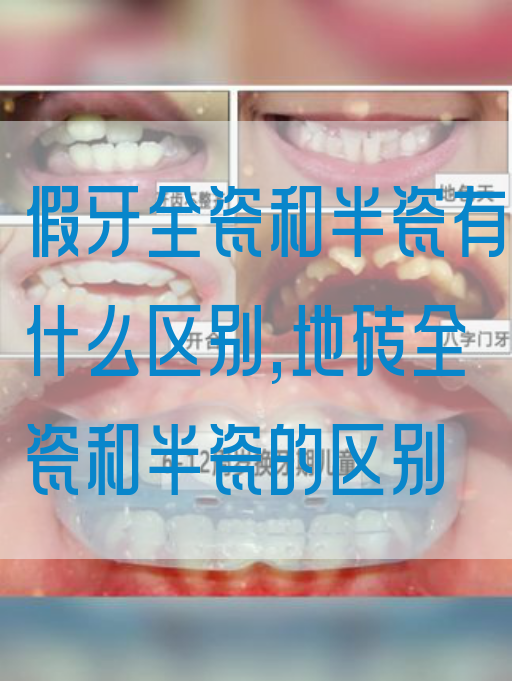 假牙全瓷和半瓷有什么区别,地砖全瓷和半瓷的区别(图1)