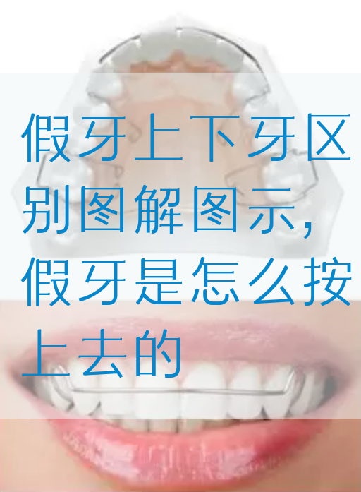 假牙上下牙区别图解图示,假牙是怎么按上去的(图1)