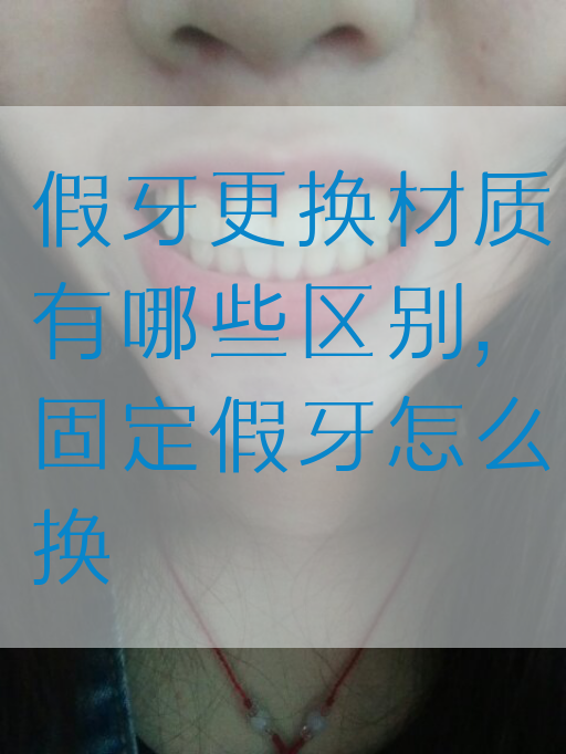 假牙更换材质有哪些区别,固定假牙怎么换(图1)