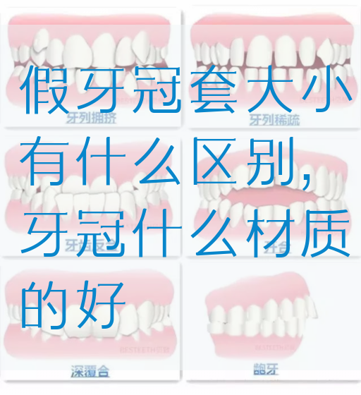 假牙冠套大小有什么区别,牙冠什么材质的好(图1)