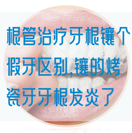 根管治疗牙根镶个假牙区别,镶的烤瓷牙牙根发炎了(图1)