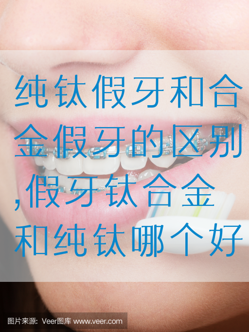 纯钛假牙和合金假牙的区别,假牙钛合金和纯钛哪个好(图1)