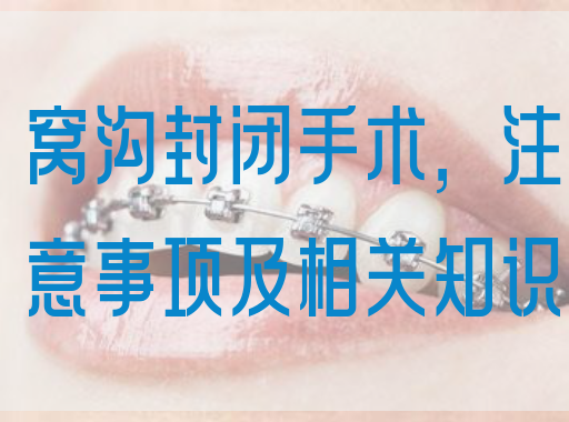 窝沟封闭手术，注意事项及相关知识(图1)