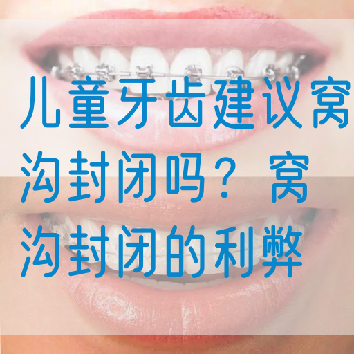 儿童牙齿建议窝沟封闭吗？窝沟封闭的利弊(图1)