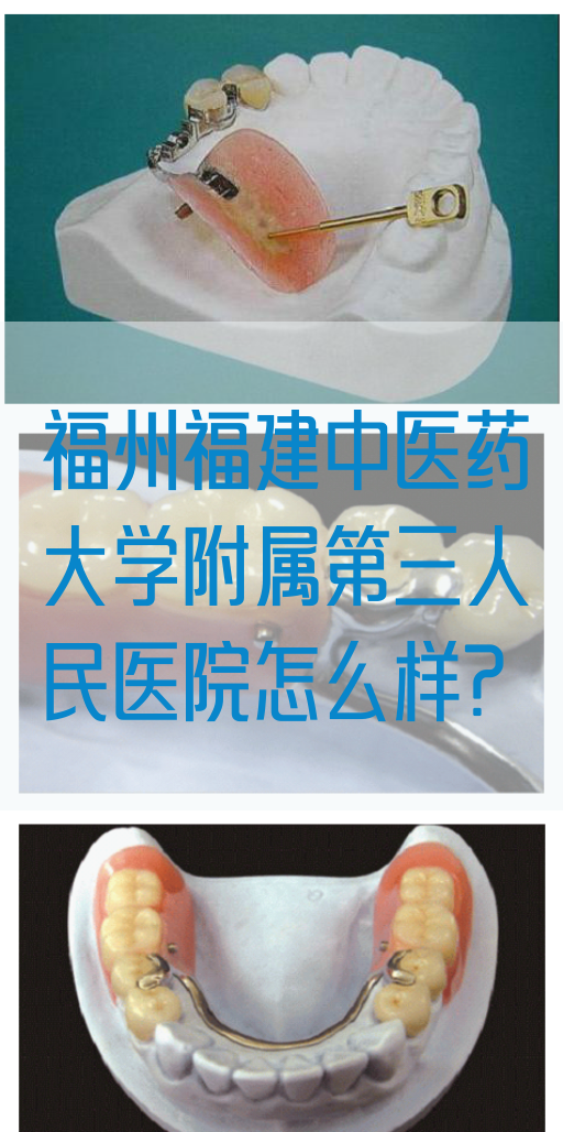 福州福建中医药大学附属第三人民医院怎么样?
