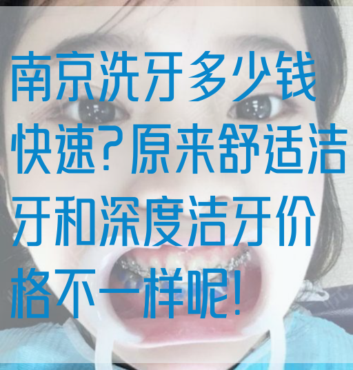 南京洗牙多少钱快速?原来舒适洁牙和深度洁牙价格不一样呢!