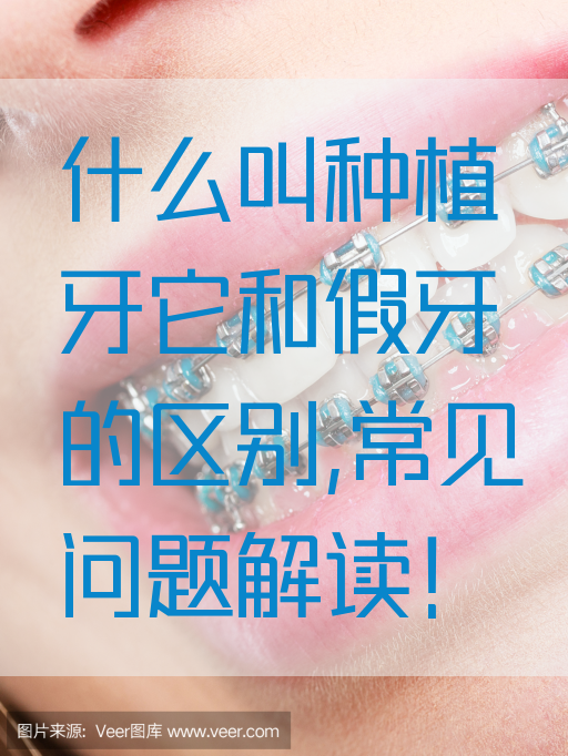 什么叫种植牙它和假牙的区别,常见问题解读！