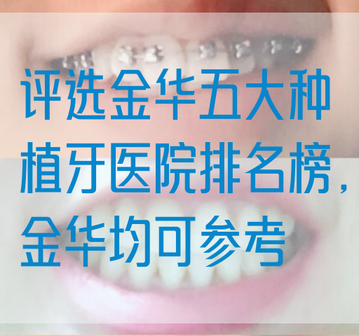 评选金华五大种植牙医院排名榜，金华均可参考