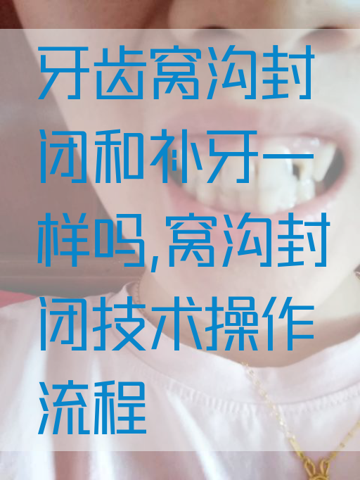 牙齿窝沟封闭和补牙一样吗,窝沟封闭技术操作流程(图1)