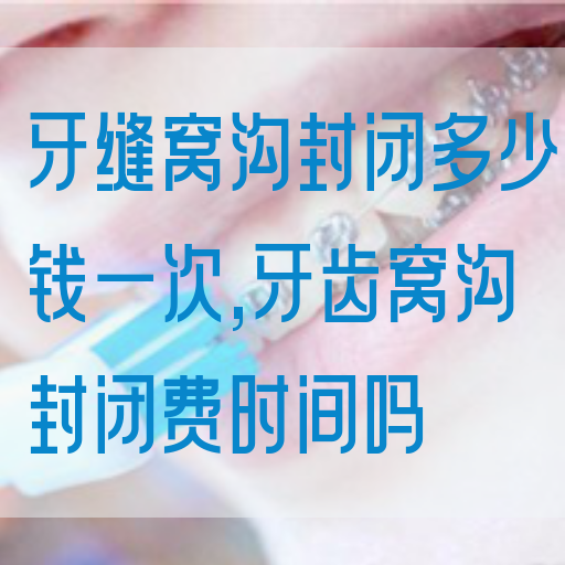牙缝窝沟封闭多少钱一次,牙齿窝沟封闭费时间吗(图1)