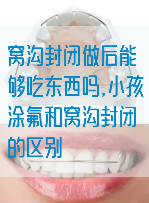 窝沟封闭做后能够吃东西吗,小孩涂氟和窝沟封闭的区别(图1)