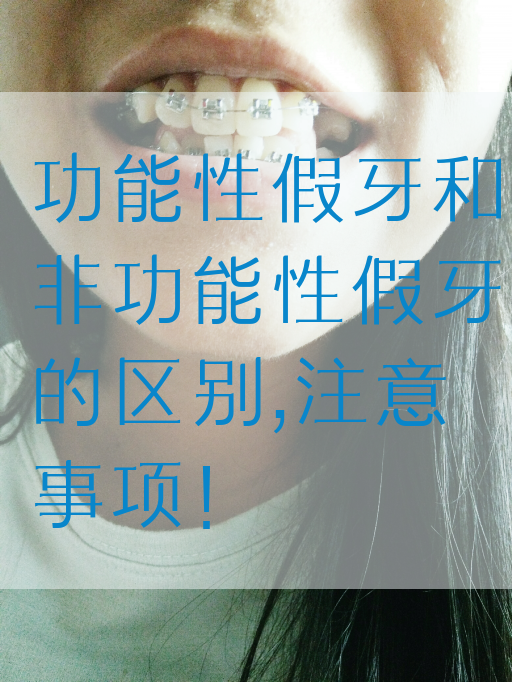 功能性假牙和非功能性假牙的区别,注意事项！