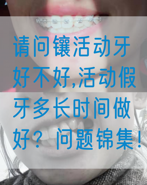 请问镶活动牙好不好,活动假牙多长时间做好？问题锦集！
